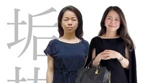 ‘못생겼다’ 놀림받던 日여성, 성형 없이 3만 장 셀카로 인생 바꿔 