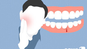 단순 잇몸 염증인 줄 알았는데…8주 지나도 안 낫는다면