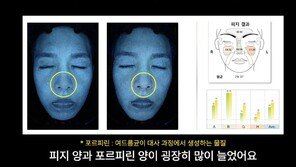 설탕·밀가루만 먹었더니…피부과 의사 피부 나이 5년 늙었다