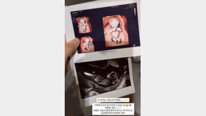 혼전임신 김지영, 임신 12주차 태명 공개 “성별 궁금해”