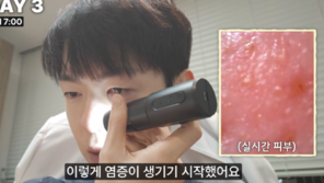 “7일 만에 피부 나이 ‘5살’ 폭삭” 피부과 의사, 직접 실험한 결과는?