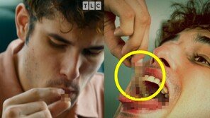 “바퀴벌레 내장은 커스터드 맛” 매일 곤충 100마리 먹는 美남성