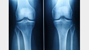 ‘꿈’ 같던 연골 재생, 현실로? 스탠포드대, 관절염 치료 새 돌파구