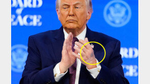 트럼프 손등에 또 멍자국…“테이블에 부딪혔다” 해명