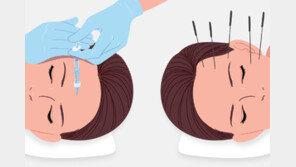 주사값 3분의 1로 피부재생 약침 시술… 한의원 미용진료 논란