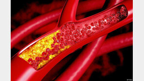 피부보다 먼저 늙는 혈관-관절… 콜라겐 감소는 ‘노화 신호’
