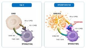“위암에 쓰는 ‘이 항암제’, 남성에만 효과”…이유 있었다
