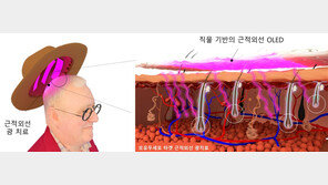 KAIST “모자처럼 쓰는 OLED 치료기로 탈모 막아요”