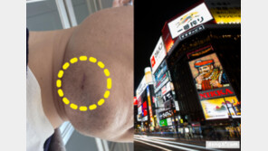 [단독] “앞니 3개 부러지고 피범벅” 韓관광객 日서 집단폭행 당해