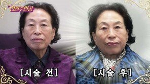 “곱게 나이 들고 싶다”…전원주, 500만 원 피부 시술 받아