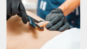 ‘사망자 지방’ 쓰는 미용 시술 등장…美서 관심 집중