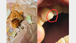 “햄버거 먹다가 이빨 깨졌다”…본사가 내놓은 보상비용은?