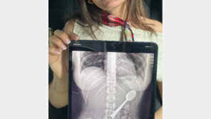 입에 숟가락 물고 문자 하다…강아지 뛰어들어 ‘꿀꺽’ 