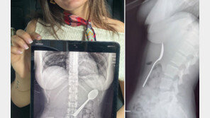 입에 숟가락 물고 문자 하다…강아지 뛰어들어 ‘꿀꺽’ 