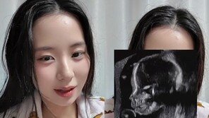 ‘최현석 딸’ 최연수, 초음파 사진 공개…“엄청 익숙한 얼굴이 보여”