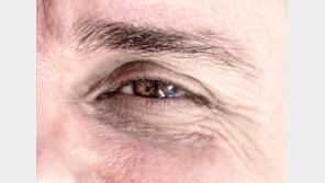“눈 작아진 게 노화 탓?”…‘전신 통증’ 부르는 갱년기 OOOO