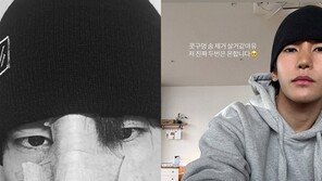 육준서, 부러진 코 재건 성공…“두 번은 못해” 