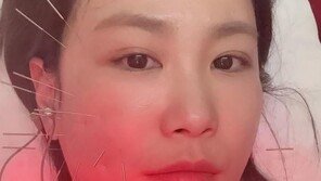 2세 준비하는 김지민 욕실 낙상사고 “볼 함몰됐다”