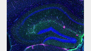 운동이 뇌를 보호하는  ‘생물학적 기전’ 발견[노화설계]