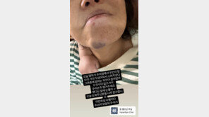 황보라, 어머니 사고에 눈물 “의식 잃고 쓰러져”