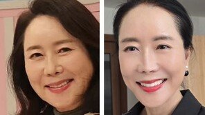 64세 윤영미 “1년간 가장 잘한 일”…안면거상·다이어트 후 근황