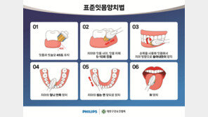 시큰시큰한 잇몸, 원인은 수면부족… “이렇게 예방해요”