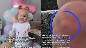 “3살 아이 통증, 괜찮다는 말 믿지 않았다”…희귀병 징조 찾아낸 英 엄마