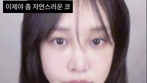 “눈밑지+코성형 1개월”…랄랄, 확 달라진 비주얼 공개