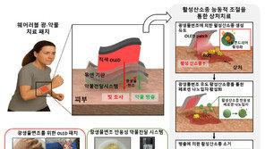 상처에 빛 쏴서 약물량 조절 ‘스마트 패치’ 나왔다