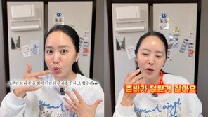 박지윤, 라방 앞두고 외모 걱정…“가라앉을 줄 알았는데 멍 남아”
