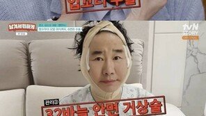 팽현숙 “최양락 안면거상·박피·모발이식·쌍커풀 시술해”