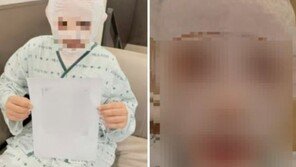 끓는 물 부은 남편 감쌌던 아내, “처벌 원해” 마음 바꿨다