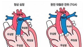 “완전 대혈관 전위 환자 수술후 30년 생존율 90%”