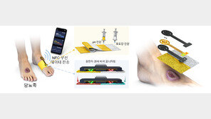 당뇨발 상처 눈으로 실시간 확인하는 스마트 패치 개발