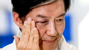 김용남, 멍든 조국에 “파란색 얼마나 부러우면 얼굴 시퍼렇게 만드나”