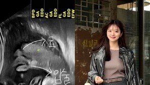 김지영, 출산 8주 앞두고 초음파 사진 공개 “곧 만난다”