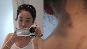폐암 투병 이혜영 “곳곳에 수술 흉터…이겨내고 세상 나올 것”
