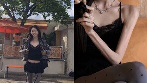 최준희, 살가죽만 남은 ‘극세사’ 팔 자랑