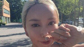 44세 슈, 레이저 시술 후 매끈 피부 자랑…금발 변신