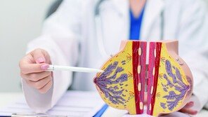 유방암 생존율 95%… ‘치료 후 삶’도 챙겨야