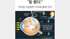 빛 봤다! 英 시각장애 2人 전자칩 인공망막 이식에 성공