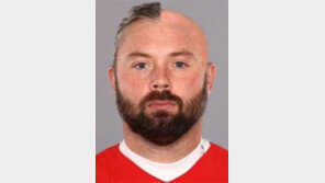 캔자스시티 킬고어 머리, 반만 남은 이유는…