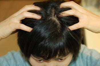 干性头皮屑2、3天洗一次为宜，油性头皮屑请避免使用护发素 : 东亚日报