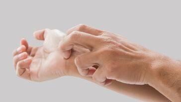 “가려워서 못 자요”…삼육대 기숙사 ‘옴’ 환자에 발칵