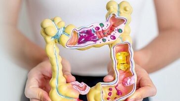 젊은 대장암 급증, 장내 유해균이 만든 ‘특정 독소’가 원인