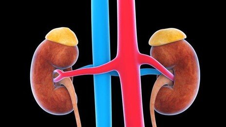 조용히 퍼지는 ‘만성 콩팥병’, 전 세계 사망 원인 9위