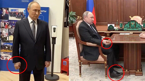 퉁퉁 부은 푸틴의 오른손…다시 불거진 ‘건강이상설’