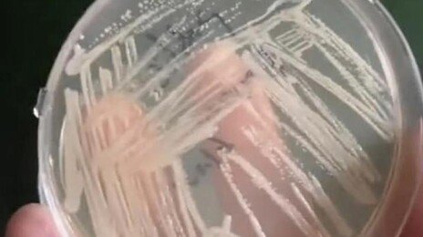 슬리퍼 없이 샤워 금물…헬스장 바닥에서 세균 폭발