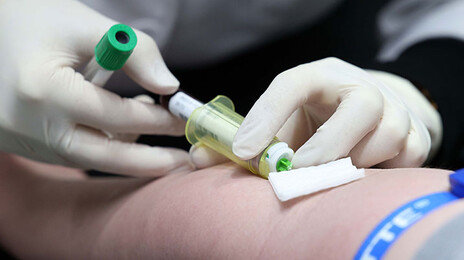 혈액-소변 검사 5개사, 입찰 담합의혹