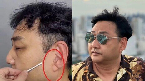 쓰러진 김수용 귓불에 깊은 사선 주름…심혈관 이상 전조?